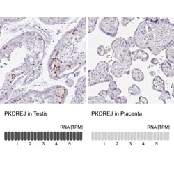 PKDREJ Antibody, Novus Biologicals 0.1mL; Unlabeled:Antibodies, Polyclonal